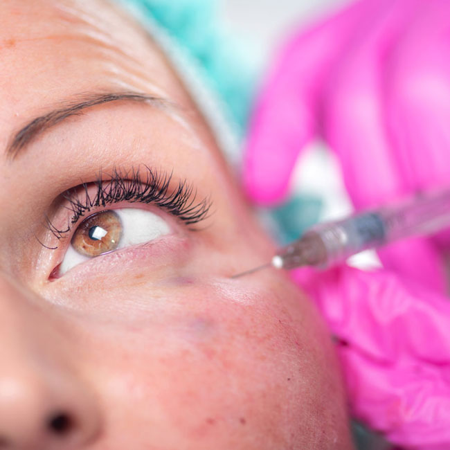 La Best Dermal Fillers Belotero injection