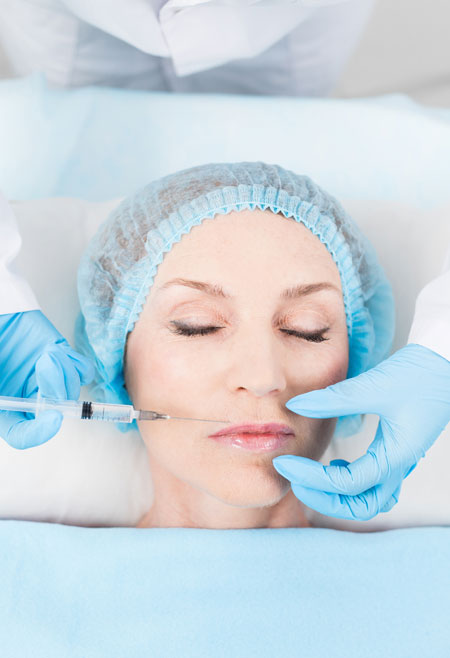 La Best Dermal Fillers radiesse injection