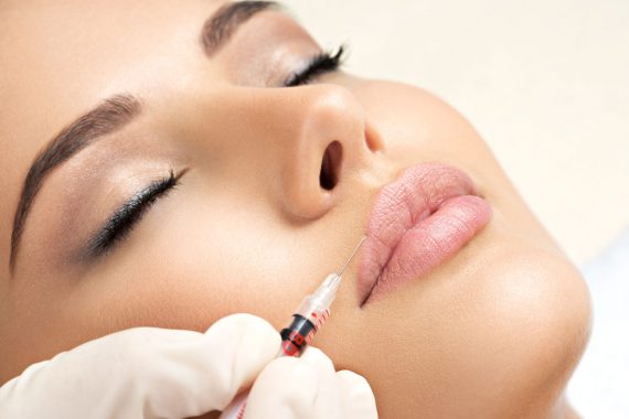 best dermal fillers in Los Angeles