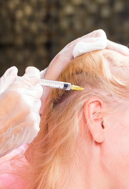 La Best Dermal Fillers PRP Hair Restoration La Best Dermal Fillers PRP Hair Restoration