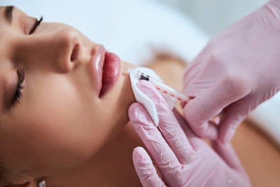 myth dermal fillers debunked