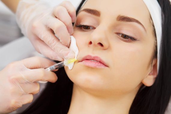 best times of the year to get dermal fillers