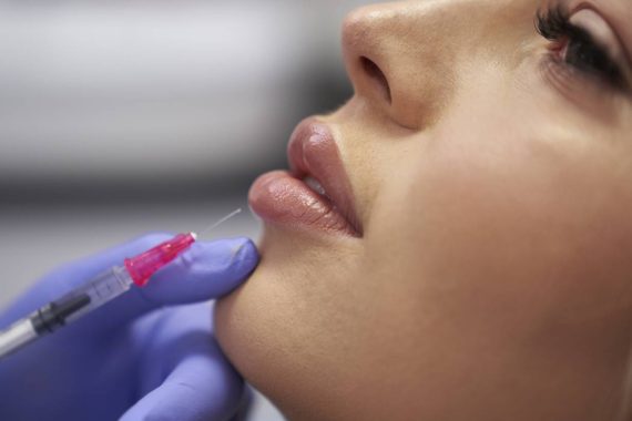 discovering the best botox and lip filler treatments in los angeles