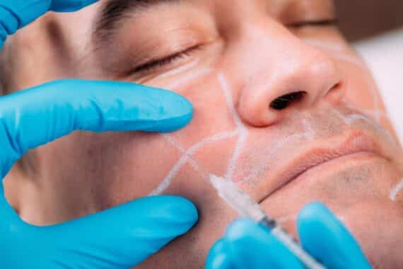 dermal fillers compare to other anti aging treatments