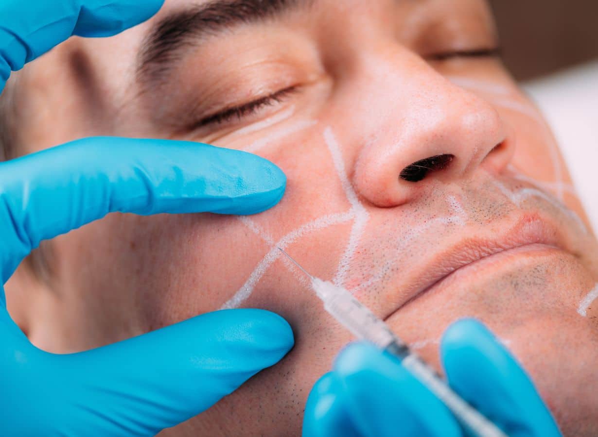 dermal fillers compare to other anti aging treatments