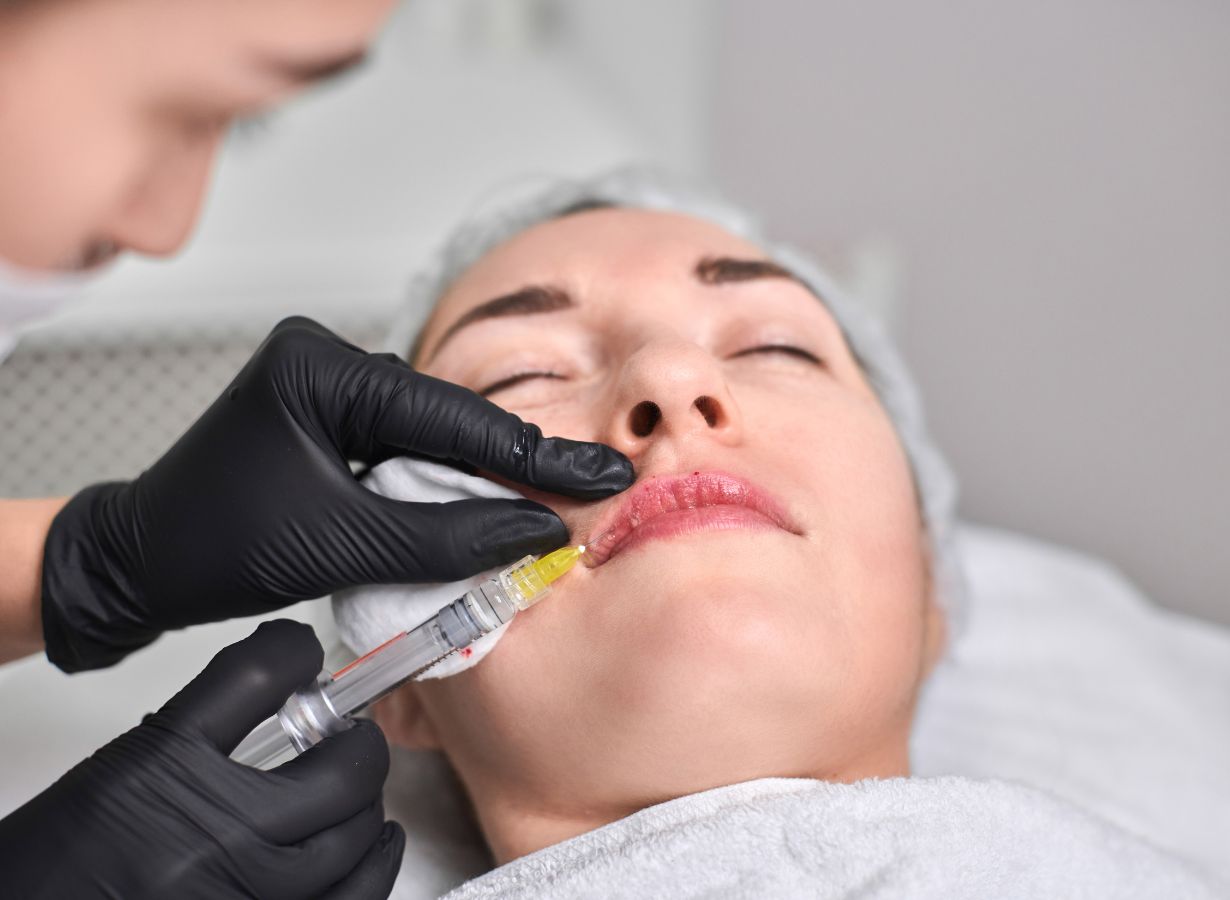 how long does swelling last after dermal fillers