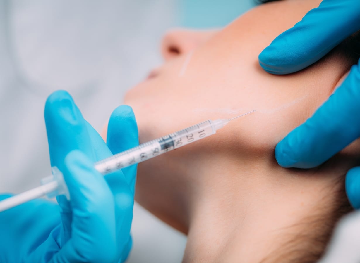 sculptra before after what results can expect