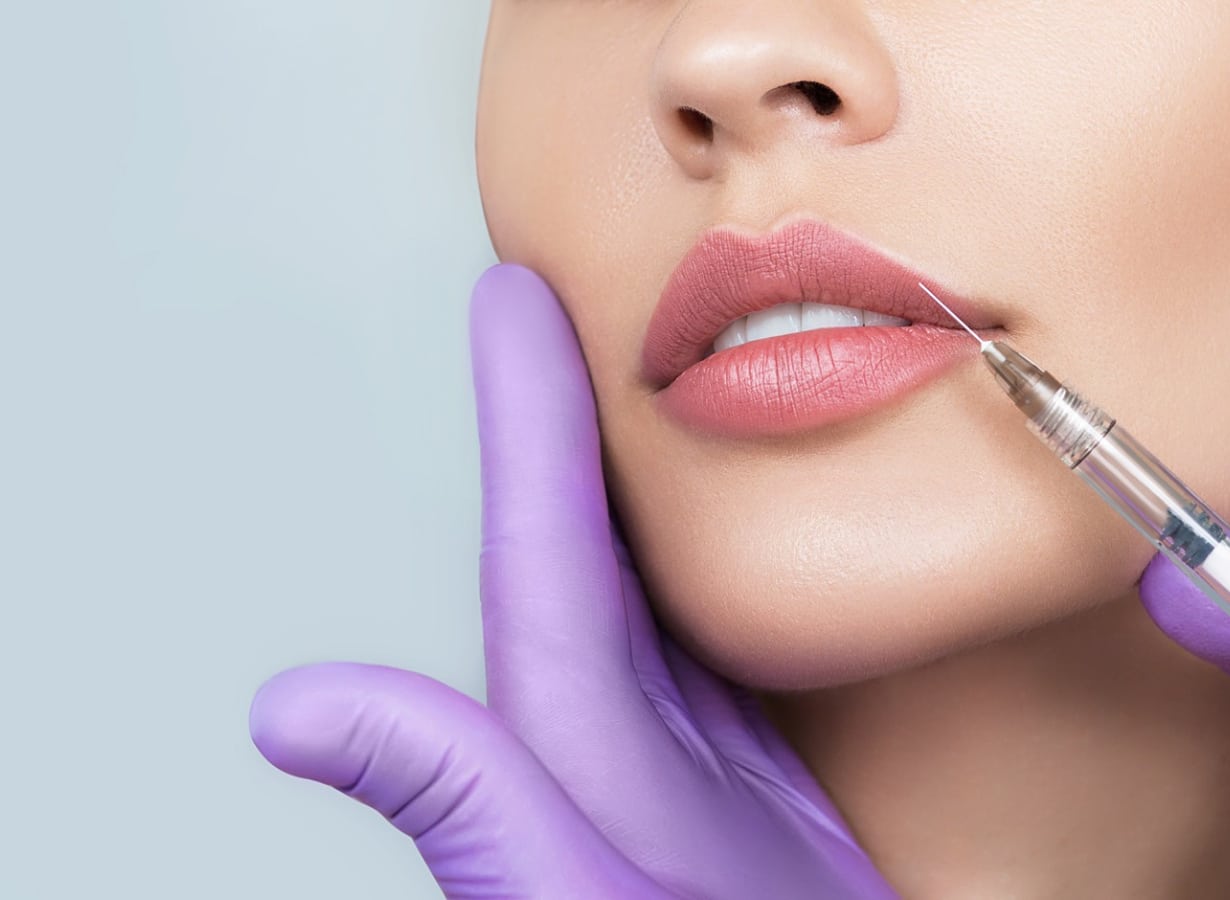 juvederm or restylane better lips cheeks smile lines